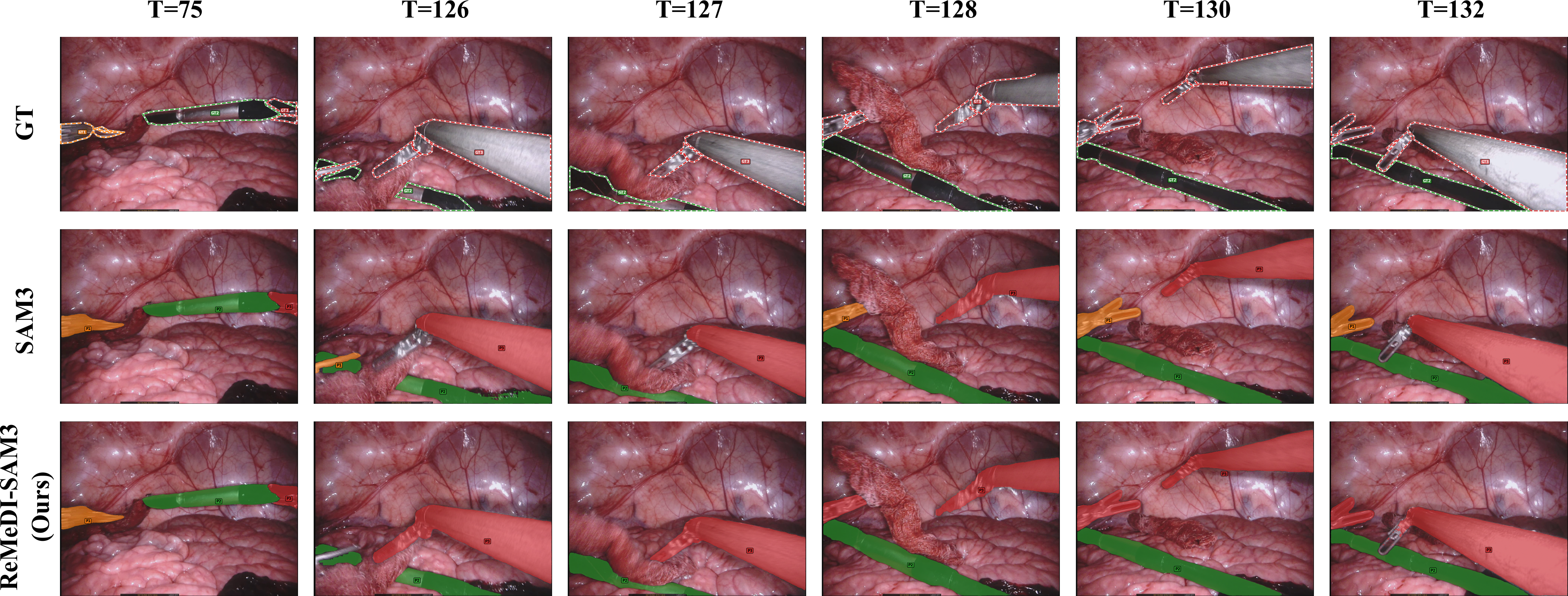 EndoVis17 qualitative results